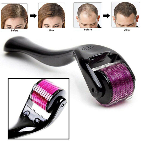 Derma Roller 0.5mm with 540 Micro Needle for Hair Growth and Facial Skin Therapy| Skin Care Beauty Tool for Anti-Aging Skin Repair, Anti Wrinkles Stretch, and Acne Scars Removal for Men and Women - Image 4