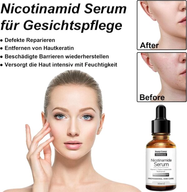 Pretty Cowry Nicotinamide Serum with Vitamin C | 30 ml Nicotinamide Face Serum for Anti-Wrinkles and Age, Even Skin, Against Blemishes and Stains - Image 7